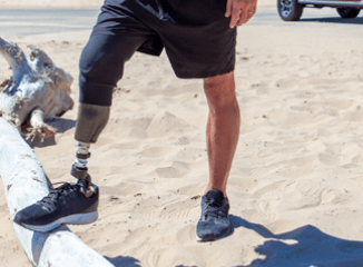 Man with prosthetic leg standing near Jeep vehicle